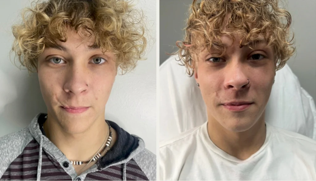 Scars and Self-Confidence: What We Know