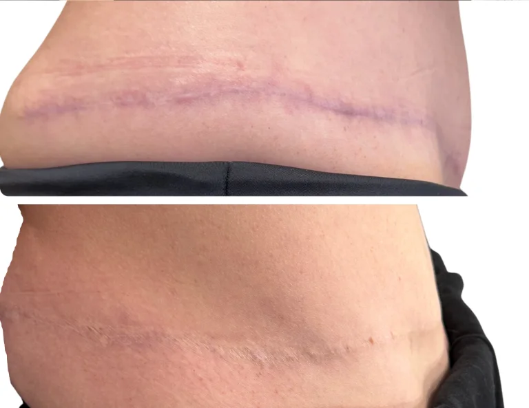 Scar Camouflage Gallery Image