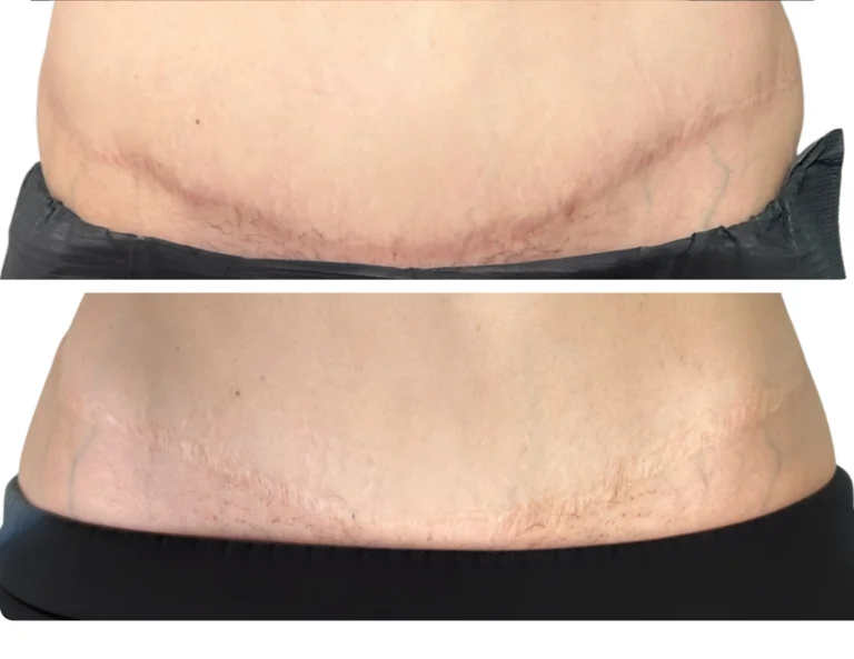 Scar Camouflage Gallery Image