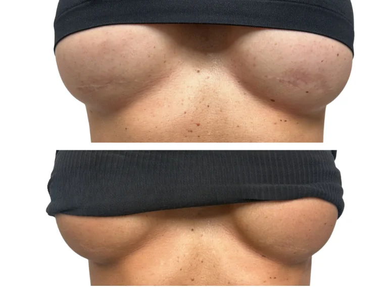 Scar Camouflage Gallery Image