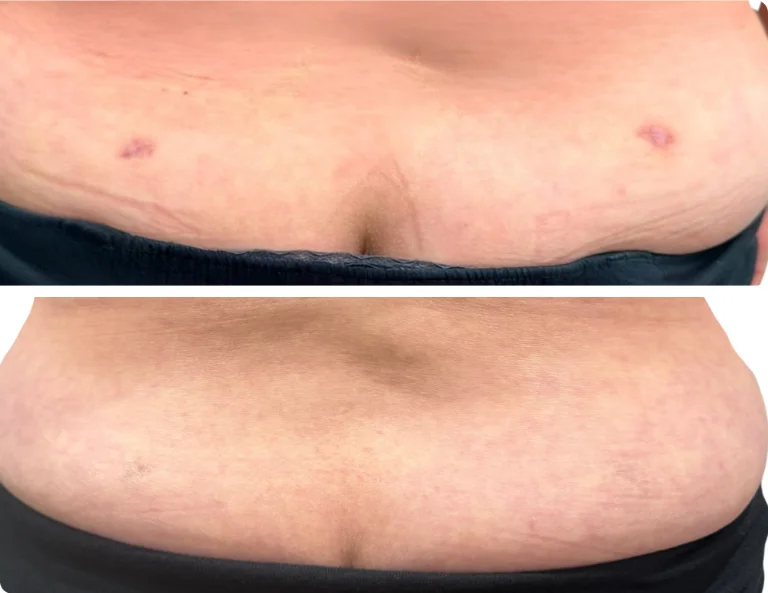 Scar Camouflage Gallery Image