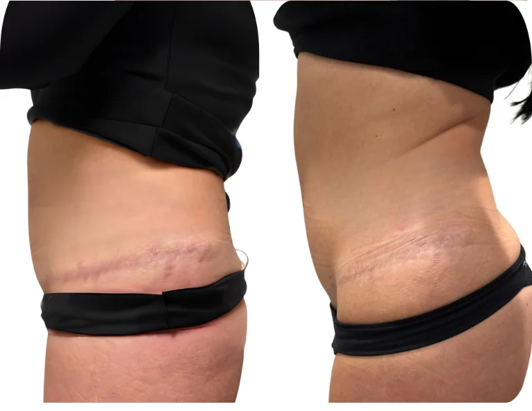 Scar Camouflage Gallery Image