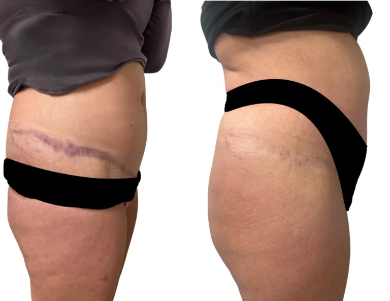 Scar Camouflage Gallery Image