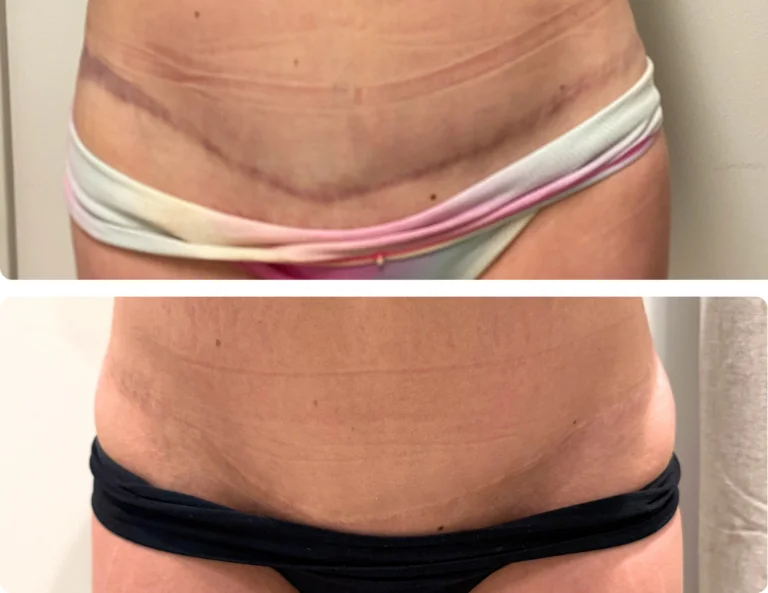 Scar Camouflage Gallery Image