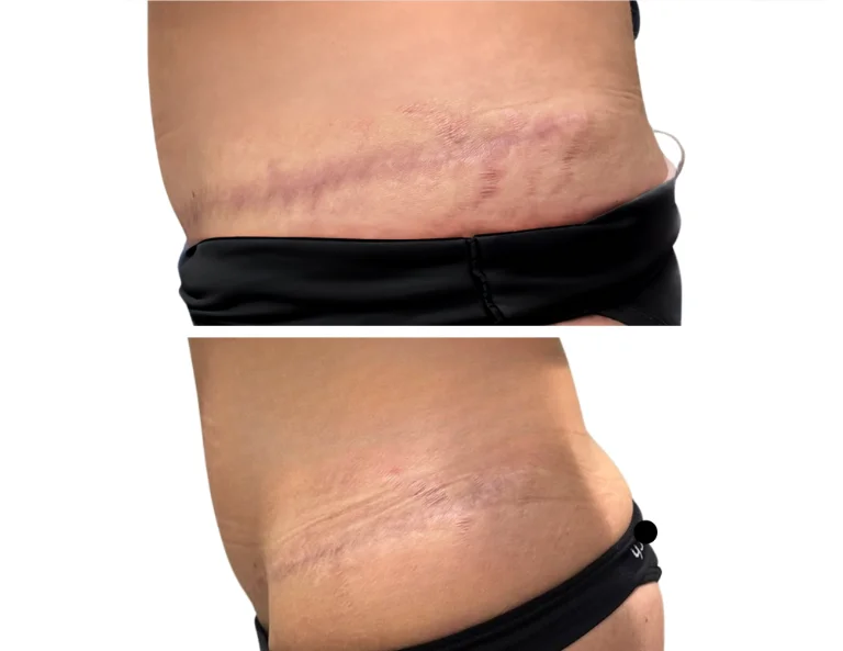 Scar Camouflage Gallery Image