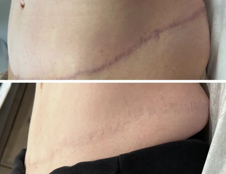 Scar Camouflage Gallery Image