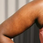 Before You Try Stretch Mark Camouflage Read This…